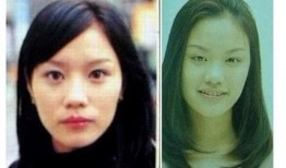 台湾爆料谁整容了啊视频,明星整容真相大曝光！